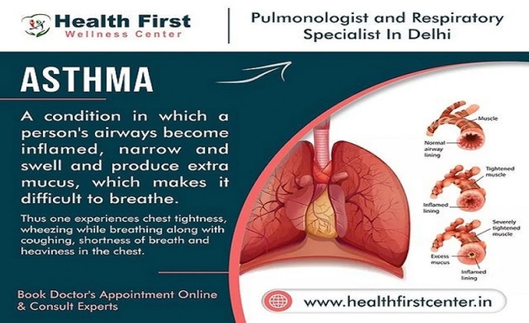 Expert Asthma Doctor in Delhi – Meet Dr. Sanchayan Roy