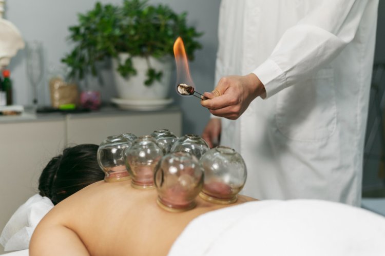 Dry Cupping Therapy: A Natural Approach